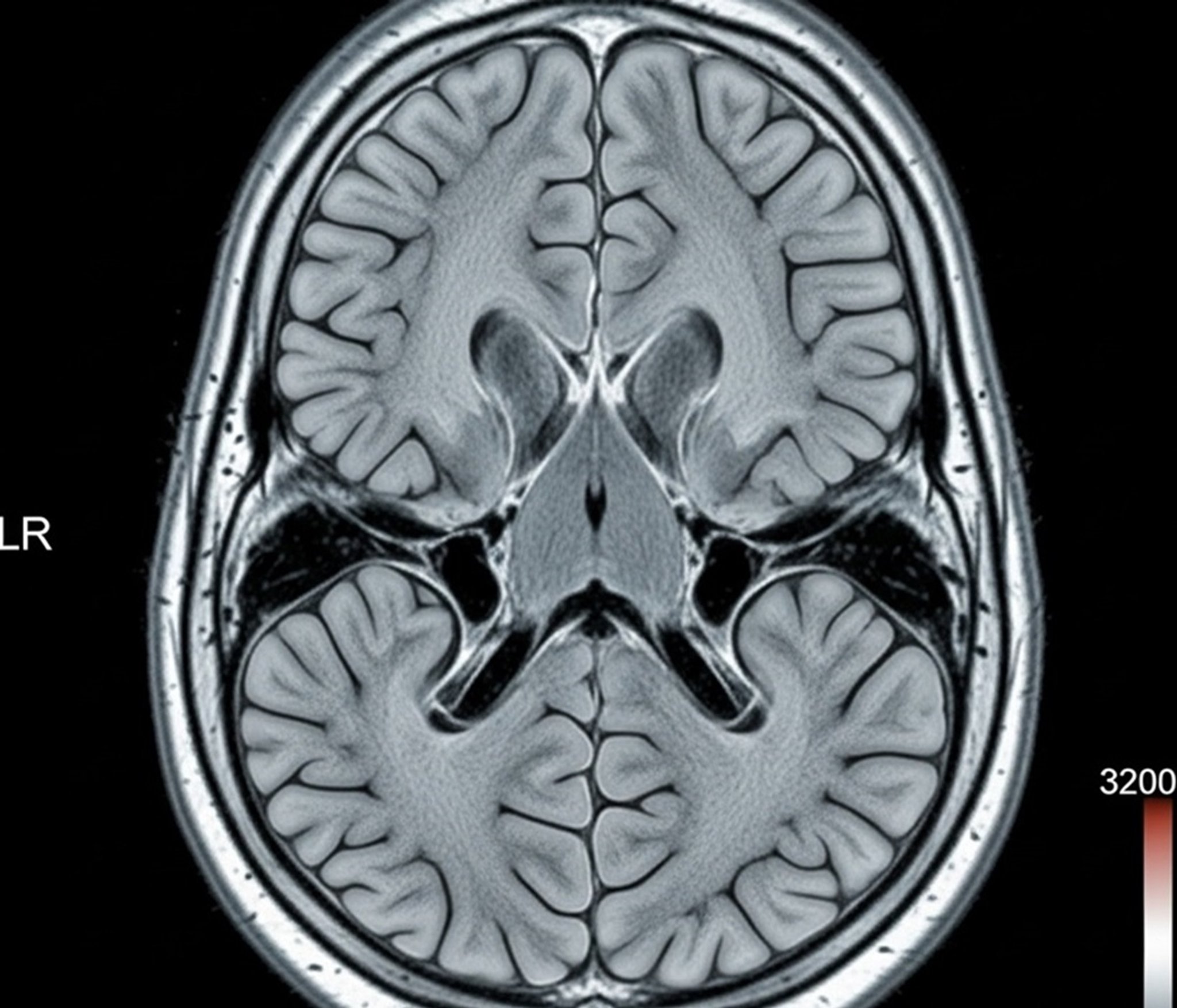 costo risonanza magnetica